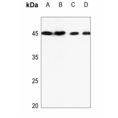 TRIB3 Rabbit Polyclonal Antibody