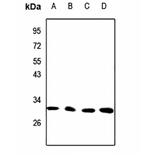 CTDSP1 Rabbit Polyclonal Antibody