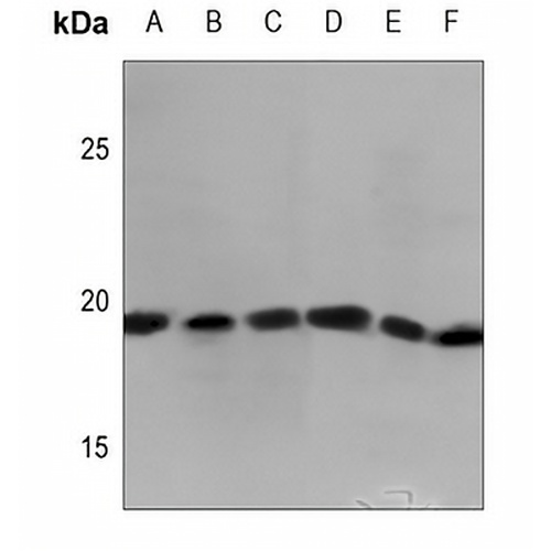 MYL7 Rabbit Polyclonal Antibody