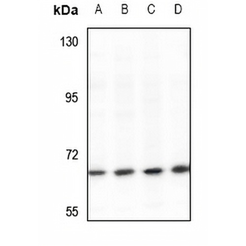 ARHGAP22 Rabbit Polyclonal Antibody