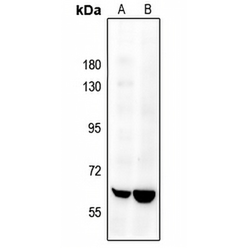 SENP2 Rabbit Polyclonal Antibody