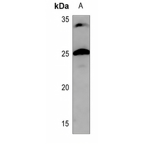 CHP2 Rabbit Polyclonal Antibody