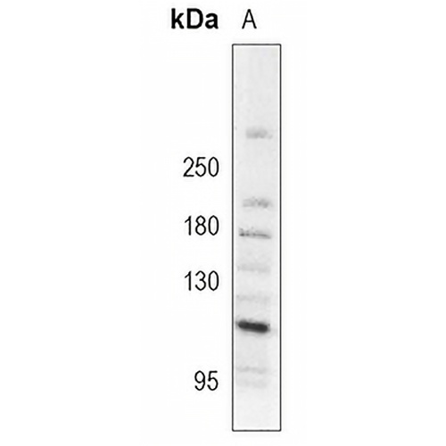 MDA5 Rabbit Polyclonal Antibody