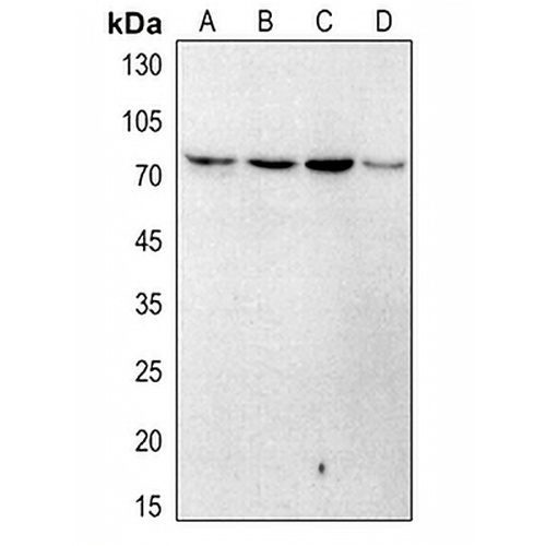 Artemis (Phospho-S516) Rabbit Polyclonal Antibody