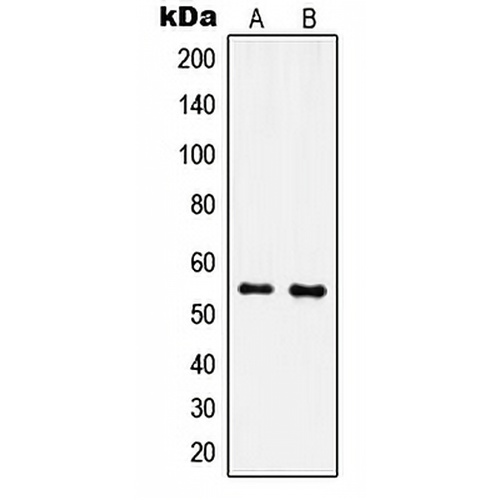 IPPK Rabbit Polyclonal Antibody