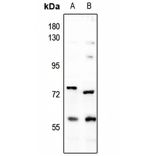 DCLRE1B Rabbit Polyclonal Antibody