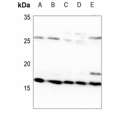 MRPL14 Rabbit Polyclonal Antibody