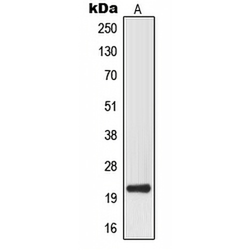 MRPL32 Rabbit Polyclonal Antibody