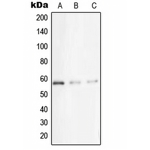 STK33 Rabbit Polyclonal Antibody