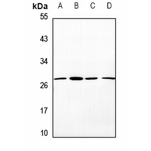 OTUB2 Rabbit Polyclonal Antibody