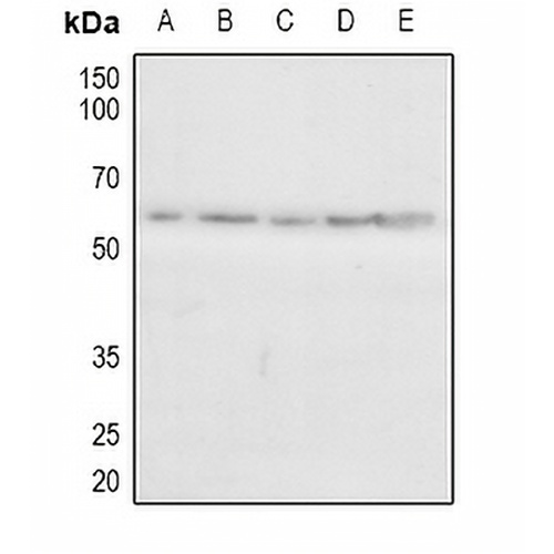 CAMKV Rabbit Polyclonal Antibody