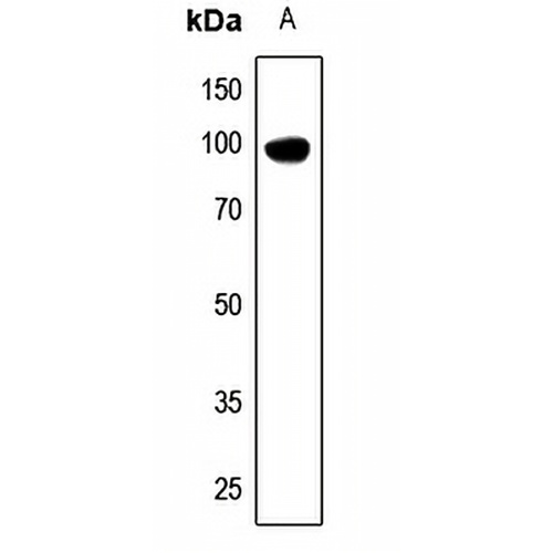DDX54 Rabbit Polyclonal Antibody