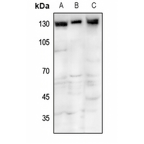 TRPM8 Rabbit Polyclonal Antibody
