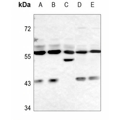 FTO Rabbit Polyclonal Antibody