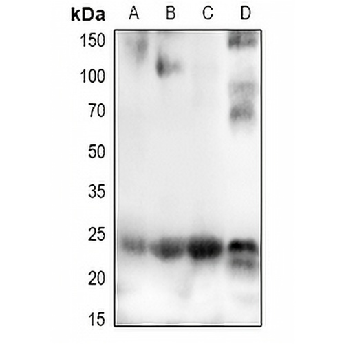CHAC1 Rabbit Polyclonal Antibody