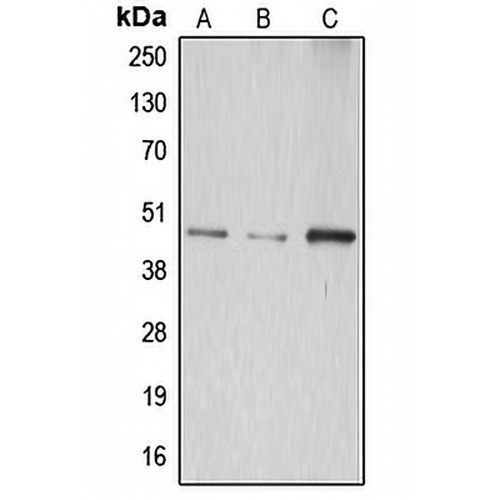 ABHD8 Rabbit Polyclonal Antibody