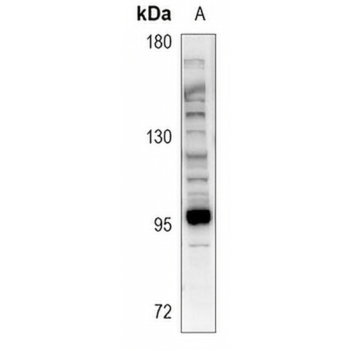 Microcephalin Rabbit Polyclonal Antibody