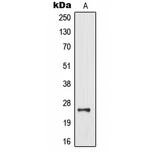 MOB3B Rabbit Polyclonal Antibody