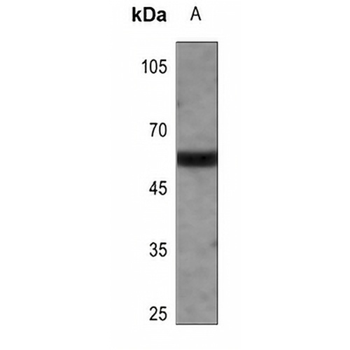 PANK2 Rabbit Polyclonal Antibody