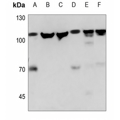 NAA15 Rabbit Polyclonal Antibody