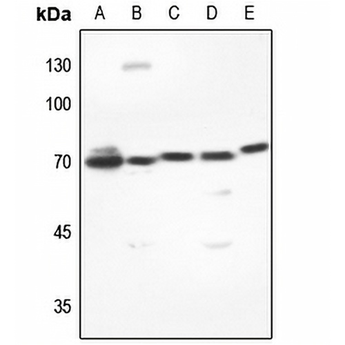 DUSP16 Rabbit Polyclonal Antibody