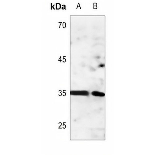 ANT4 Rabbit Polyclonal Antibody