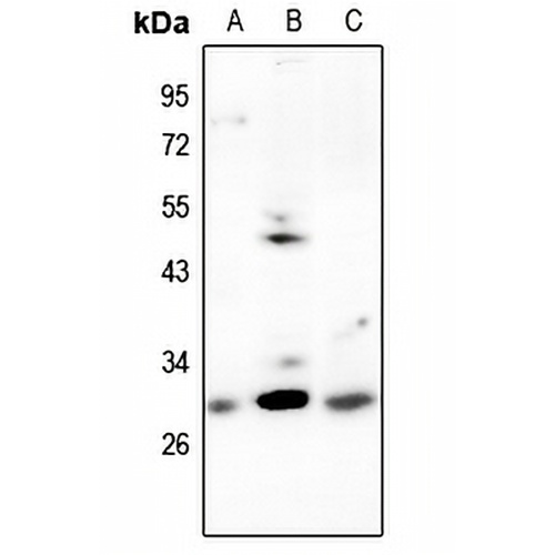 CDCA3 Rabbit Polyclonal Antibody
