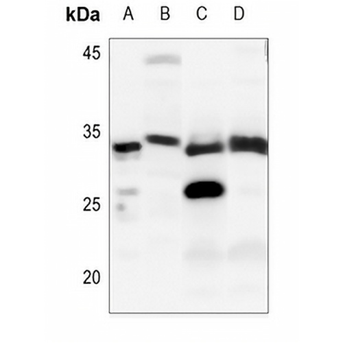 DNAL1 Rabbit Polyclonal Antibody