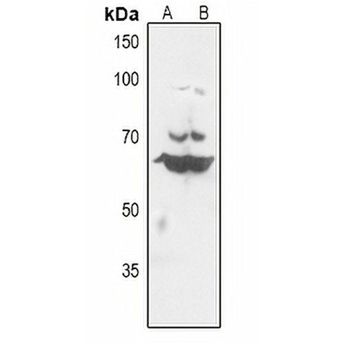 Histone Deacetylase 10 Rabbit Polyclonal Antibody