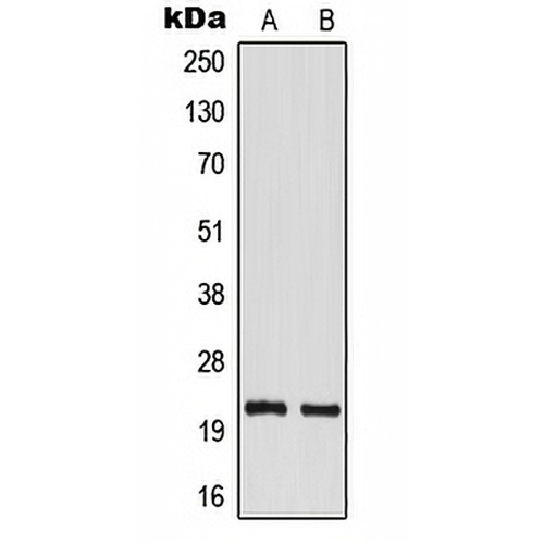 TM2D1 Rabbit Polyclonal Antibody