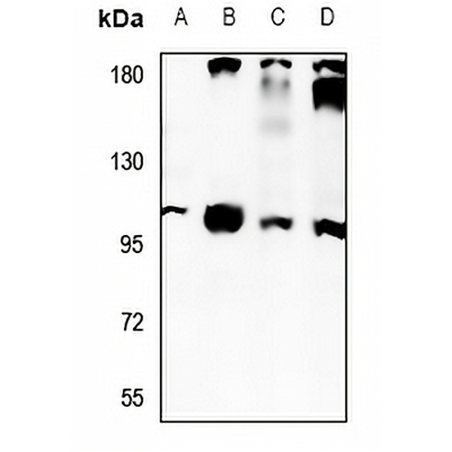 NaBC1 Rabbit Polyclonal Antibody