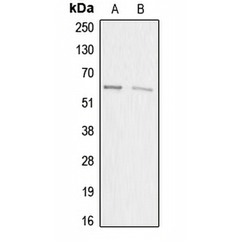 ACRBP Rabbit Polyclonal Antibody