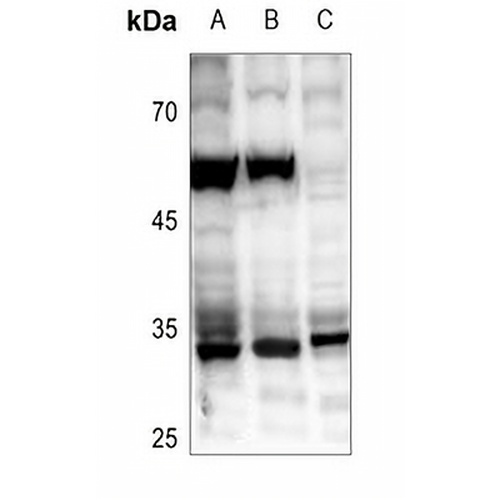 ZC3H8 Rabbit Polyclonal Antibody
