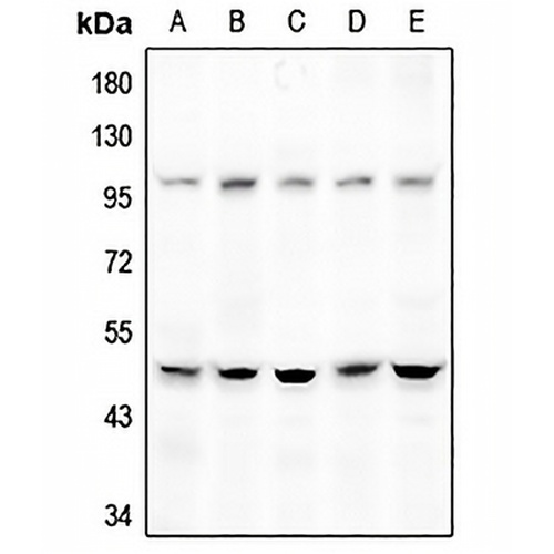 DGAT2 Rabbit Polyclonal Antibody