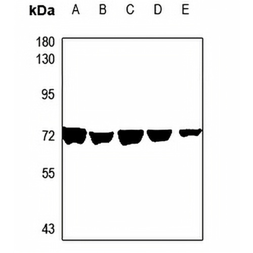 AGBL4 Rabbit Polyclonal Antibody