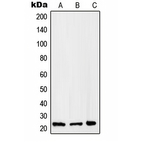 RAB2B Rabbit Polyclonal Antibody