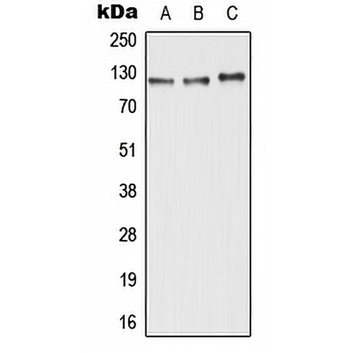 ABCC11 Rabbit Polyclonal Antibody