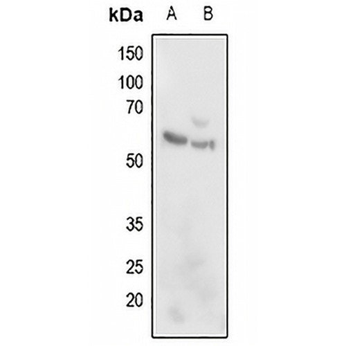 ARMC6 Rabbit Polyclonal Antibody