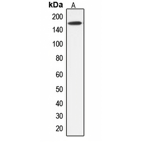 ABCC12 Rabbit Polyclonal Antibody