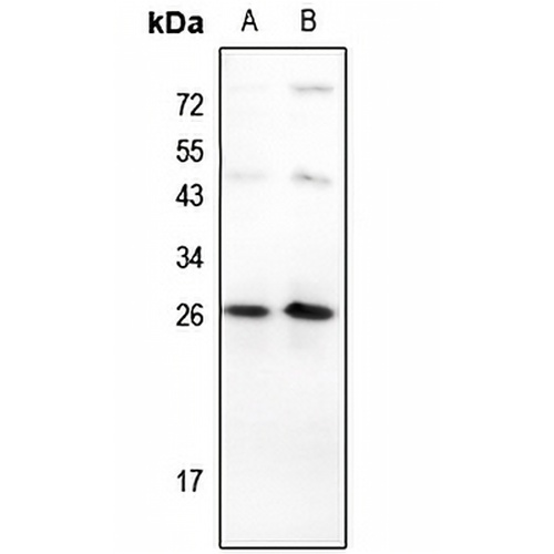 TP53INP1 Rabbit Polyclonal Antibody
