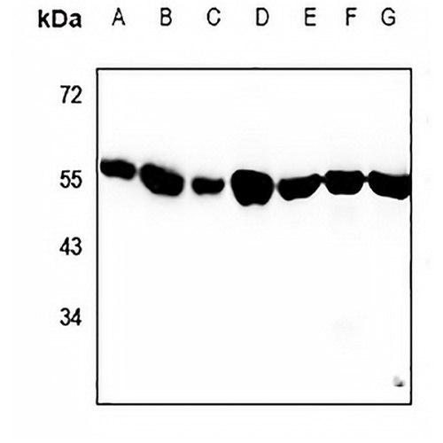 Alpha-tubulin 3C/D/E Rabbit Polyclonal Antibody