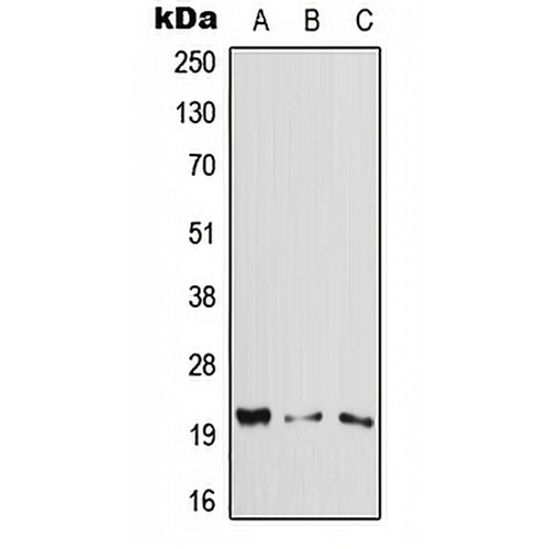 Cytoglobin Rabbit Polyclonal Antibody