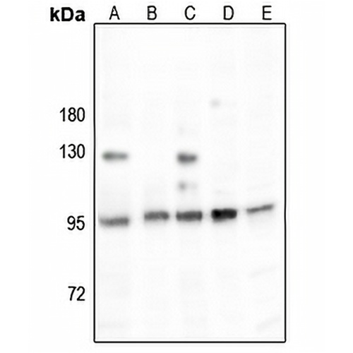 ESCO1 Rabbit Polyclonal Antibody