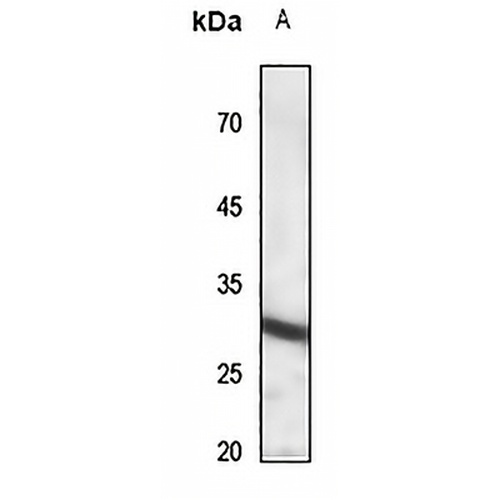 IL-22RA2 Rabbit Polyclonal Antibody