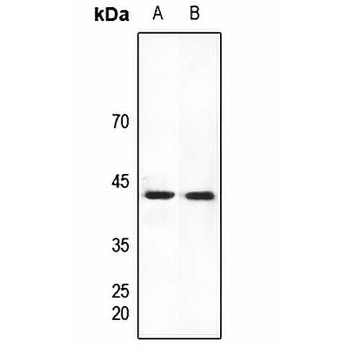 HEXIM2 Rabbit Polyclonal Antibody
