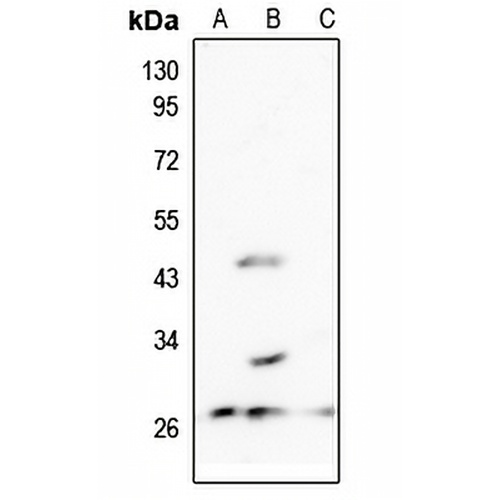 MRPL10 Rabbit Polyclonal Antibody