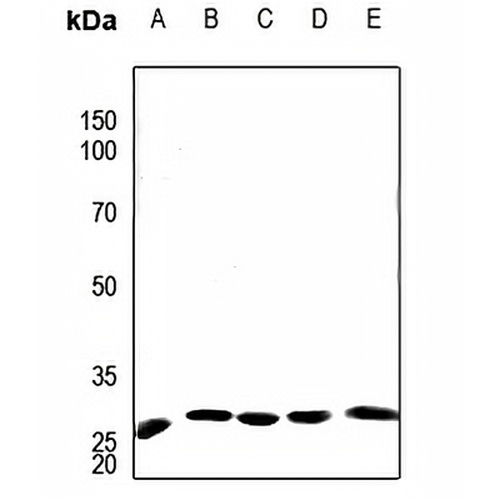 APOA1BP Rabbit Polyclonal Antibody