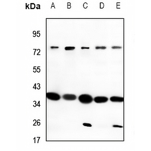 CD200R Rabbit Polyclonal Antibody