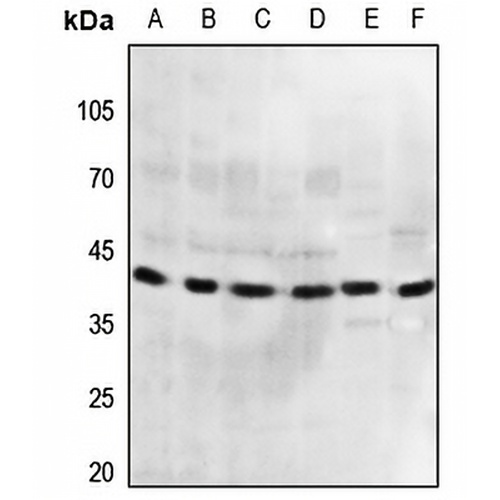 GPR175 Rabbit Polyclonal Antibody