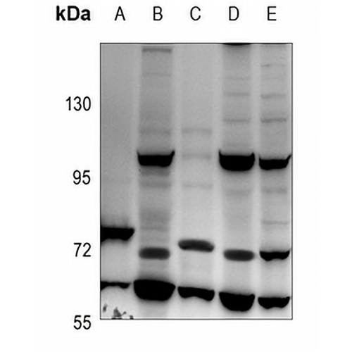 IL-31RA Rabbit Polyclonal Antibody